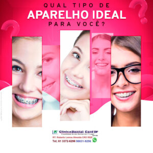 Aparelho ortodôntico Implantes odontológicos Implantes dental Clinica odontológica brasilia Densita em ceilandia Dentista de criança
