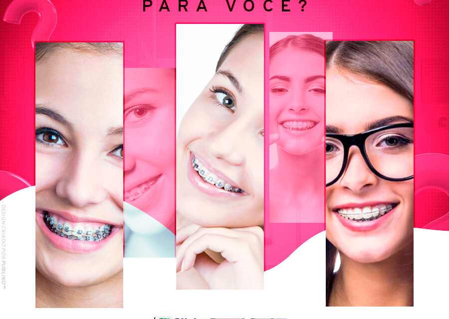 Aparelho ortodôntico Implantes odontológicos Implantes dental Clinica odontológica brasilia Densita em ceilandia Dentista de criança